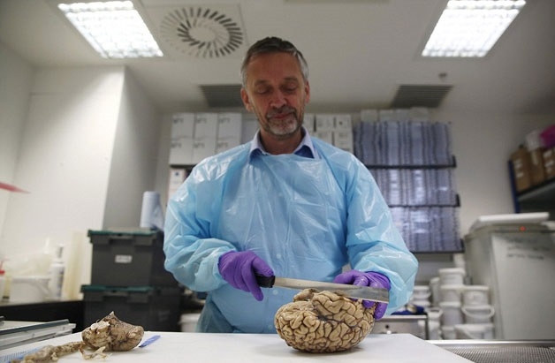 İngiltere'nin en büyük beyin bankası galerisi resim 5