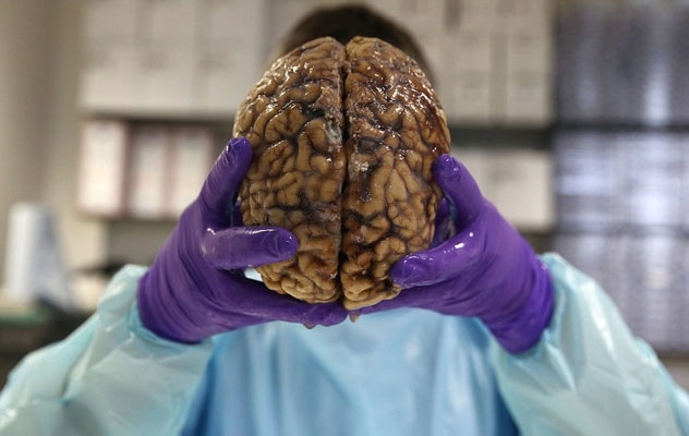 İngiltere'nin en büyük beyin bankası galerisi resim 6