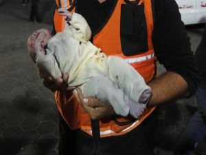 Gazze Sağlık Bakanlığı: Açlık ve susuzluk nedeniyle 2 bebek hayatını kaybetti