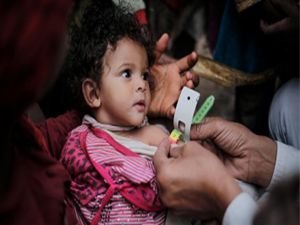 Yemen'de 100 binden fazla kolera şüphelisi var