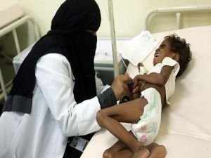 Yemen'de çocuklar açlıktan ölüyor