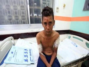 BM: Yemen'de haftada en az 123 sivil hayatını kaybediyor