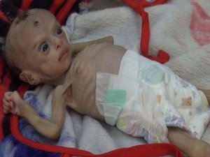 Yemen'de her 2 saatte bir anne ve 6 bebek ölüyor