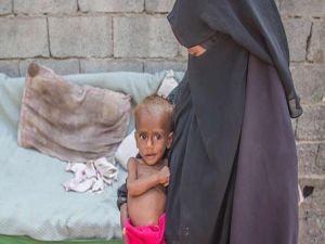 Yemen'de milyonlarca hamile ve emziren kadın ile çocuk açlığın pençesinde