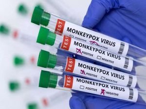 KKTC'de bir kişide maymun çiçeği virüsü tespit edildi