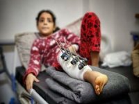 İşgalci siyonistlerin saldırılarında her gün 10 çocuk bacaklarını kaybediyor
