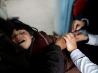 BM: Yemen'de kolera salgını kontrolden çıkıyor