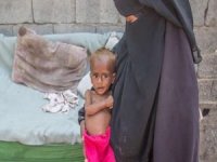 UNICEF: Yemen'de 7 milyon çocuk her gece yatağa aç giriyor