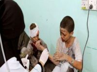 Yemen'de binlerce çocuk katledildi