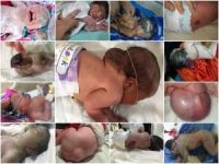 ABD'nin kullandığı kimyasal silahlar nedeniyle bebekler özürlü doğuyor