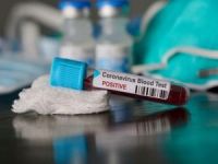 Fransa, Türkiye'den gelenlere Coronavirus testi yapmaya başladı