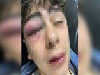 Diyarbakır'da 14 yaşındaki çocuğa işkence iddiası