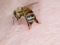 Uzmanlar ölüme varan arı alerjilerine karşı uyarıyor
